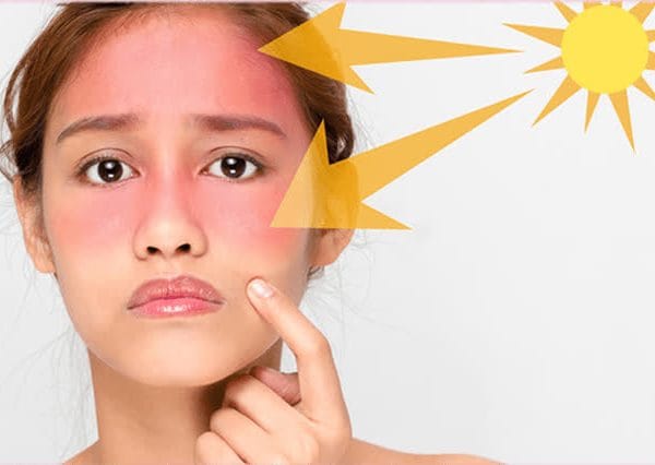 Skincare Cơ Bản Cho Người Mới