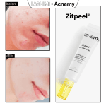 Peel da ACNEMY ZITPEEL