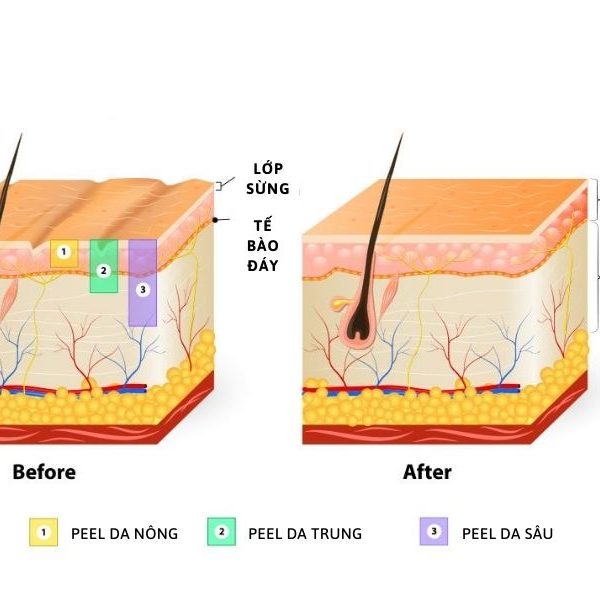 Top 5 sản phẩm peel da body tốt nhất hiện nay