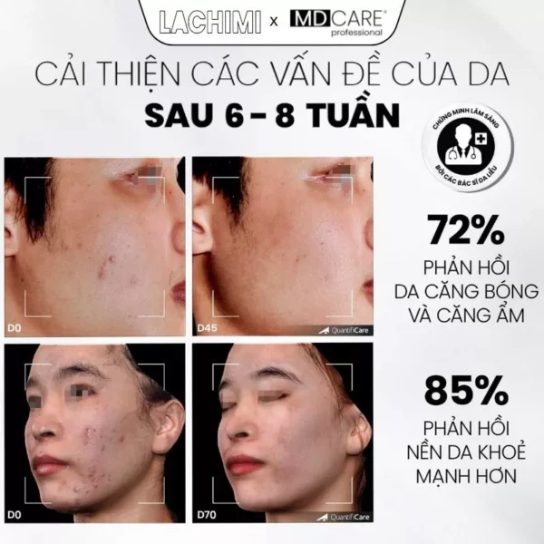 tẩy da chết AntiAc Exfo