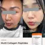 Codeage Multi Collagen Peptides
