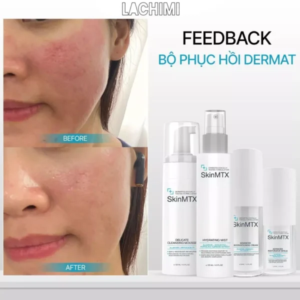 SkinMTX Advanced Reconditioning Cream