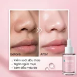 Blemish Preventing Serum Hoppa