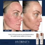 Hydrinity Hyacyn Active Mist
