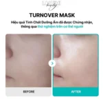 Rejuran TURNOVER MASK