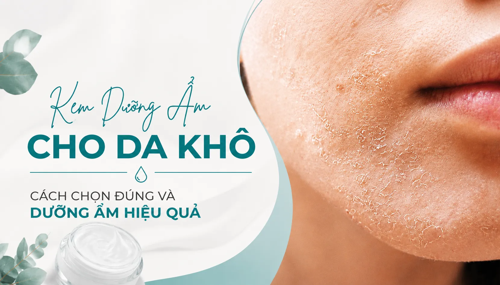 Kem Dưỡng Ẩm Cho Da Khô
