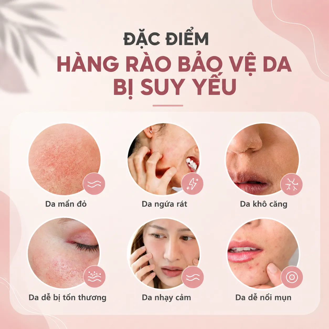 Dấu Hiệu Hàng Rào Bảo Vệ Da Bị Tổn Thương