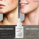 Décaar ACNE REPAIR SERUM