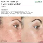 AHA 10% + BHA 2%