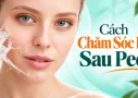 Cách Chăm Sóc Da Sau Peel