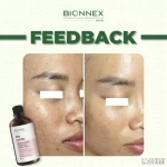 GLYCOLIC ACID 8% + ALOE VERA + BIRCH TONER