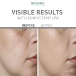 Serum Bionnex Brightening Night Repair