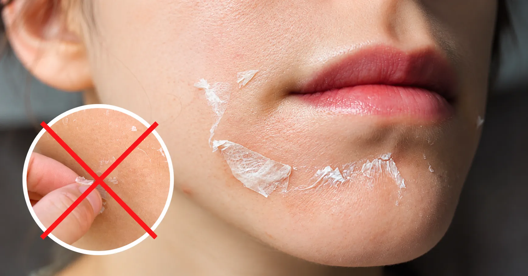 Tuyệt Đối Không Được Làm Sau Khi Peel